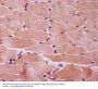 Anti-Myoglobin MB Rabbit Monoclonal Antibody