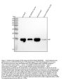 Anti-Myoglobin MB Rabbit Monoclonal Antibody
