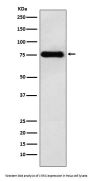 Anti-LYRIC Monoclonal Antibody
