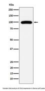 Anti-CD10 MME Monoclonal Antibody