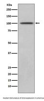 Anti-CD10 MME Rabbit Monoclonal Antibody