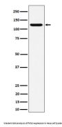 Anti-PKN2 Rabbit Monoclonal Antibody