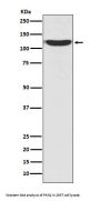 Anti-PKN2/Prk2 Rabbit Monoclonal Antibody