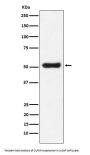 Anti-OLFM4 Monoclonal Antibody