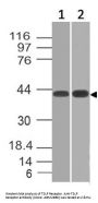 Anti-TSLP Receptor Antibody (Monoclonal, ABM28B6)