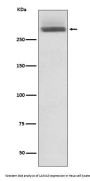 Anti-LAMA3/Laminin 5 Rabbit Monoclonal Antibody