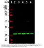 Anti-Calretinin Monoclonal Antibody