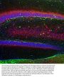 Anti-Calretinin Monoclonal Antibody