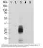 Anti-Calretinin Monoclonal Antibody