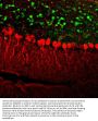 Anti-Calretinin Monoclonal Antibody