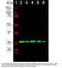 Anti-Calretinin Antibody
