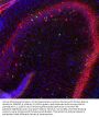 Anti-Calretinin Antibody