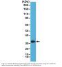 Anti-Calretinin (CALB2) Rabbit Monoclonal Antibody, Clone#RM324
