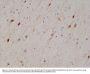 Anti-Calretinin (CALB2) Rabbit Monoclonal Antibody, Clone#RM324