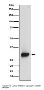 Anti-Calretinin Monoclonal Antibody