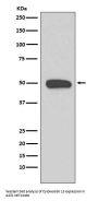 Anti-Cytokeratin 13 Rabbit Monoclonal Antibody