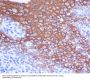 Anti-Cytokeratin 13 Rabbit Monoclonal Antibody