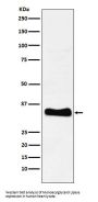 Anti-Monoacylglycerol Lipase Rabbit Monoclonal Antibody