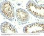 Anti-Thymidylate Synthase (5-FU Resistance Marker) TYMS Monoclonal Antibody