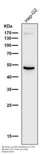 Anti-ADFP PLIN2 Rabbit Monoclonal Antibody