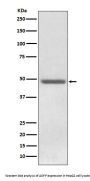 Anti-ADFP PLIN2 Rabbit Monoclonal Antibody