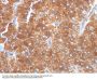 Anti-Adipophilin / Perilipin-2 (Marker of Obesity) Monoclonal Antibody