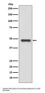 Anti-Urokinase Rabbit Monoclonal Antibody