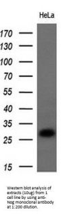 Anti-Noggin (NOG) Mouse Monoclonal Antibody [Clone ID: OTI1C1]