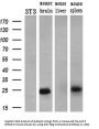 Anti-Noggin (NOG) Mouse Monoclonal Antibody [Clone ID: OTI1C1]
