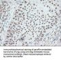 Anti-Noggin (NOG) Mouse Monoclonal Antibody [Clone ID: OTI1C1]