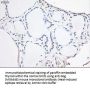 Anti-Noggin (NOG) Mouse Monoclonal Antibody [Clone ID: OTI1C1]