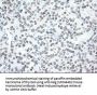 Anti-Noggin (NOG) Mouse Monoclonal Antibody [Clone ID: OTI1C1]