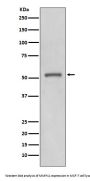 Anti-MMP11 Rabbit Monoclonal Antibody