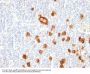 Anti-CD15 / FUT4 (Reed-Sternberg Cell Marker) Monoclonal Antibody