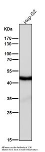 Anti-Cyclin E2 CCNE2 Rabbit Monoclonal Antibody