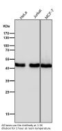 Anti-Cyclin E2 CCNE2 Rabbit Monoclonal Antibody