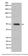 Anti-Cyclin E2 CCNE2 Rabbit Monoclonal Antibody