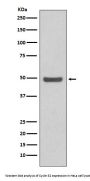 Anti-Cyclin E2 CCNE2 Rabbit Monoclonal Antibody