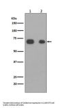 Anti-Caldesmon CALD1 Rabbit Monoclonal Antibody