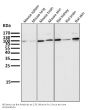 Anti-ALDH1L1 Rabbit Monoclonal Antibody