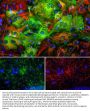 Anti-Aldehyde Dehydrogenase Family 1 Member L1 ALDH1L1 Monoclonal Antibody