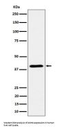 Anti-ADH4 Rabbit Monoclonal Antibody