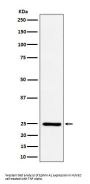 Anti-Ephrin A1 Rabbit Monoclonal Antibody