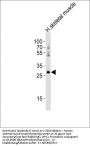 Anti-Mouse Hoxb1 Antibody (C-term)