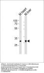 Anti-Mouse Hoxb1 Antibody (C-term)