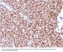 Anti-NKX2.2 (Neuroendocrine & Ewing's Sarcoma Marker) Monoclonal Antibody