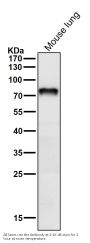 Anti-Netrin 1 NTN1 Monoclonal Antibody