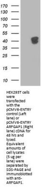 Anti-ARFGAP1 Mouse Monoclonal Antibody [Clone ID: OTI1F6]