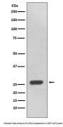 Anti-UCHL3 Rabbit Monoclonal Antibody