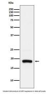 Anti-ARF5 Rabbit Monoclonal Antibody